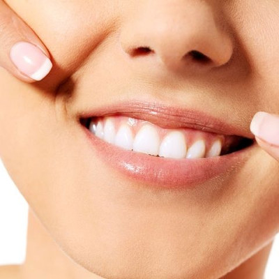 Παγκόσμια Ημέρα Στοματικής Υγείας: Ο ειδικός μάς λύνει τις απορίες (βίντεο)