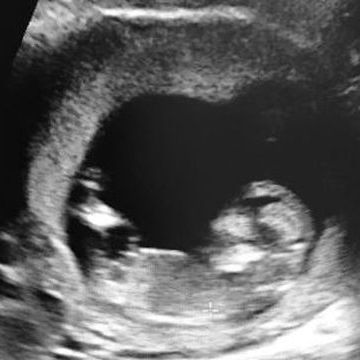 Γνωστό ζευγάρι περιμένει το πρώτο του παιδί-  Η ανακοίνωση έγινε ανήμερα της Γιορτής της Μητέρας