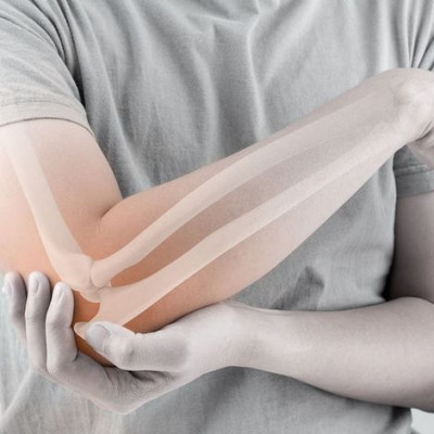 Η οστεοαρθρίτιδα μπορεί να προληφθεί – Ποια 2 μέτρα πρέπει να υιοθετήσετε