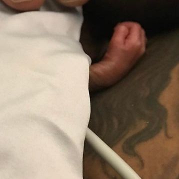 Κόρη διάσημου ζευγαριού γεννήθηκε στον 5ο μήνα. Τώρα, τέσσερις μήνες μετά βγαίνουν από τη ΜΕΝΝ