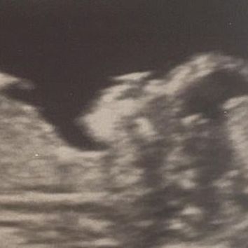 «Το μωρό μας είναι το καλύτερο δώρο που θα μπορούσαμε να κερδίσουμε ποτέ»