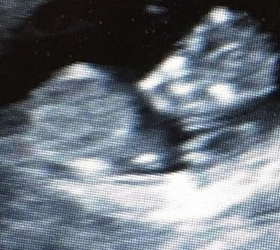 Πριν μια ώρα ανακοίνωσε τα ευχάριστα νέα! Θα γίνει μπαμπάς για δεύτερη φορά