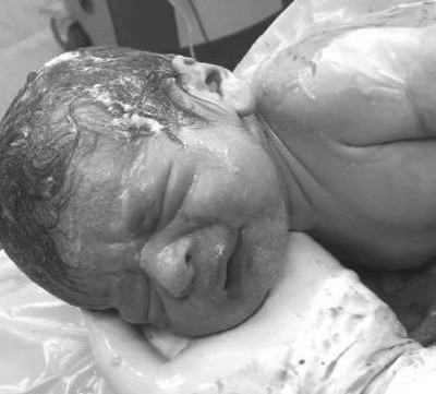 Μητέρα γεννά με «φυσιολογική καισαρική». Το viral βίντεο της ημέρας