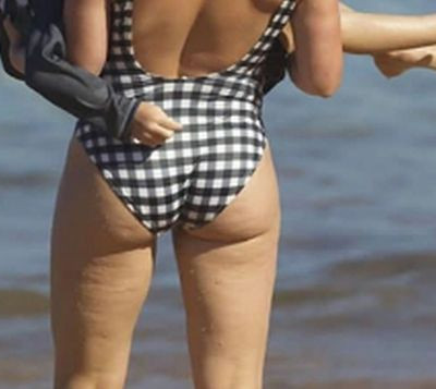 Διάσημη ηθοποιός ανεβάζει φωτογραφία της με κυτταρίτιδα και στέλνει το πιο σημαντικό μήνυμα