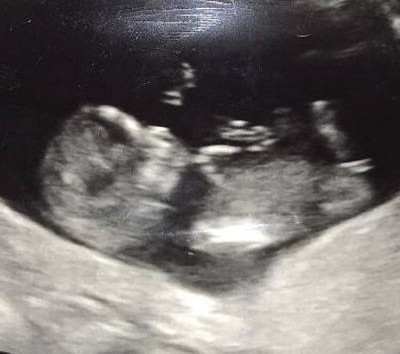 Γνωστός τραγουδιστής θα γίνει για δεύτερη φορά μπαμπάς - Ο υπέρηχος έδειξε κορίτσι