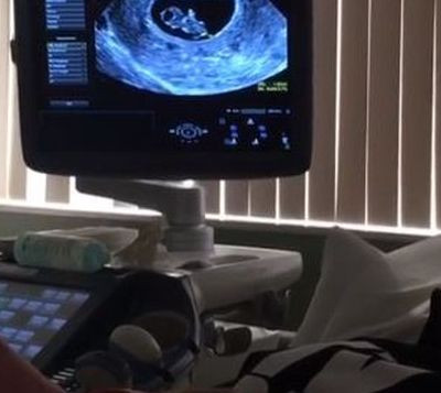 Θα γίνουν γονείς: Δημοσίευσαν για πρώτη φορά βίντεο με το υπερηχογράφημα του μωρού στο Instagram