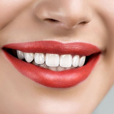 Λεύκανση δοντιών στο σπίτι: 9 + 1 πανεύκολα tips που θα λατρέψεις!