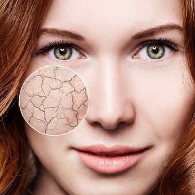 Ω7 λιπαρά: Πού βρίσκονται & ποια σημάδια φανερώνουν έλλειψη (εικόνα)