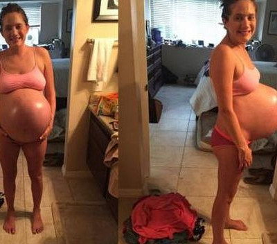 Γέννησε τρίδυμα και δημοσίευσε φωτογραφίες της μετά την εγκυμοσύνη (pics)