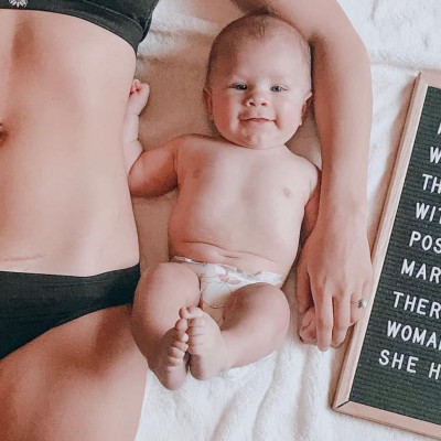 Εκπληκτικές φωτογραφίες με μαμάδες που δείχνουν το σημάδι της καισαρικής τομής (pics)