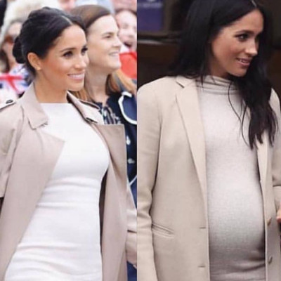 Έκανε πλαστικές για να μοιάσει στη Meghan Markle και τώρα τα παιδιά της δεν την αναγνωρίζουν (vid)