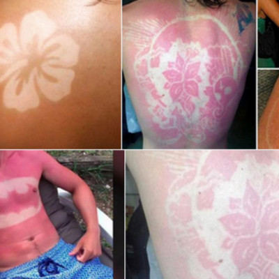 Αυτή είναι η πιο ηλίθια μόδα του φετινού καλοκαιριού!