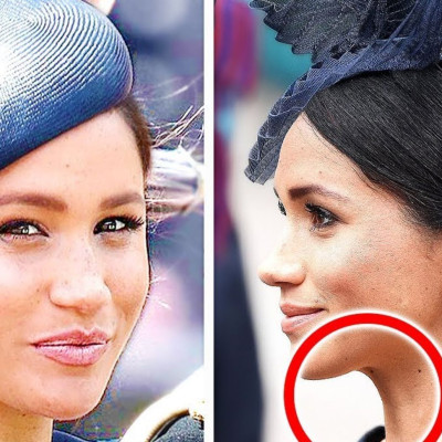 Meghan Markle: Οι αυστηροί κανόνες που αρνήθηκε να ακολουθήσει για να χάσει βάρος (vid)