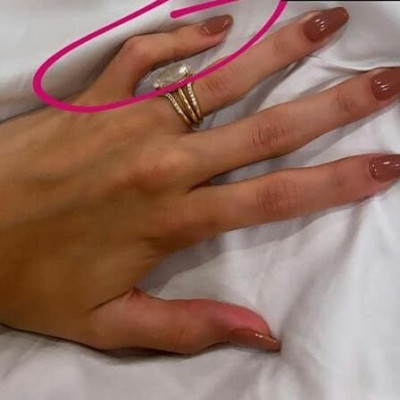 Το Instagram κορόιδευε τη Hailey Baldwin κι εκείνη αποκάλυψε τη δυσμορφία της