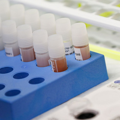 Κορονοϊός: Ενθαρρυντικά μηνύματα για το φάρμακο  - Αγώνας δρόμου από τους επιστήμονες