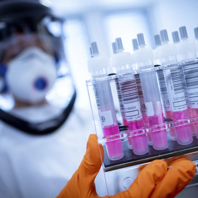 Κορονοϊός: Τι συμβαίνει με τα τεστ στην Ελλάδα - Τι αποκαλύπτει συνεργάτιδα του Τσιόδρα