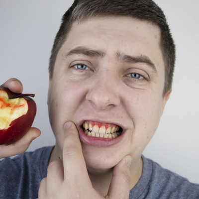 Ούλα που ματώνουν: Αντιμετώπιση με υλικά που έχετε στο σπίτι (βίντεο)