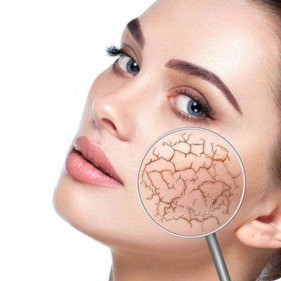 Ξηρή επιδερμίδα: 4 φυσικά υλικά για να την αντιμετωπίσετε (εικόνες)