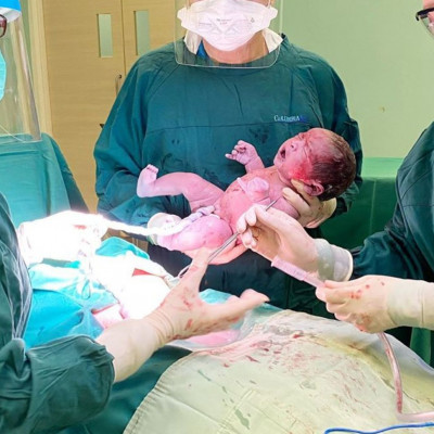 Μοναδικές φωτογραφίες παιδιών που γεννήθηκαν με καισαρική τομή (pics)