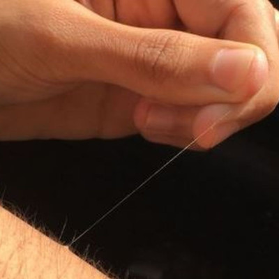 Γιατί κάποιες τρίχες στο σώμα σου μεγαλώνουν απίστευτα γρήγορα;