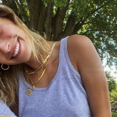 Η Hailey Bieber αποκάλυψε το φυσικό χρώμα των μαλλιών της