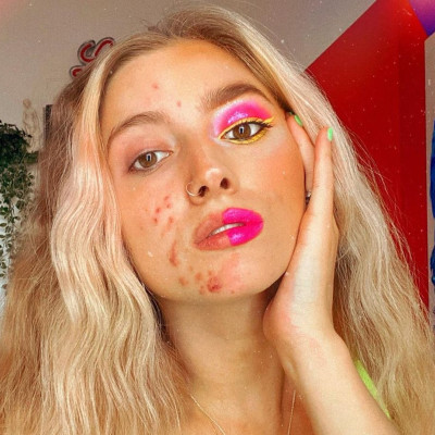 Έχεις ακμή; Αυτό είναι το προφίλ που σίγουρα θα σε εμπνεύσει