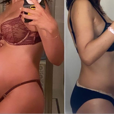 Γνωστή μαμά μας δείχνει το σώμα της πριν και μετά τη γέννα