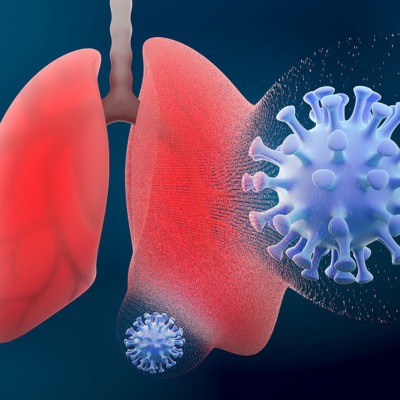 Κορονοϊός: Πόσο κινδυνεύουν οι νέοι από πνευμονία - Ποια είναι τα κοινά συμπτώματα