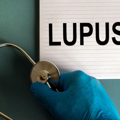 Λύκος: Τι πρέπει να προσέχετε στη διατροφή (εικόνες)