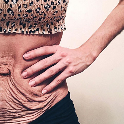 Body shaming: Δείχνει την κοιλιά της και στέλνει ένα δυνατό μήνυμα