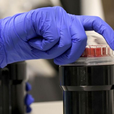 Κορονοϊός: Ελπίδα για την ανθρωπότητα - Στο 95% αποτελεσματικότητα το εμβόλιο της Moderna