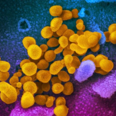 Κορονοϊός: Έτσι «χτυπάει» τους πνεύμονες μέσα σε μια ώρα!