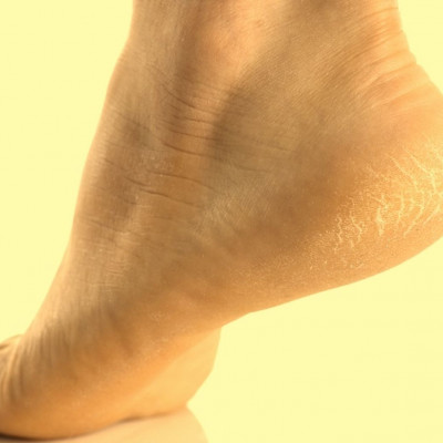 Ανεπάρκεια πρωτεΐνών: Τα ένοχα συμπτώματα (video)