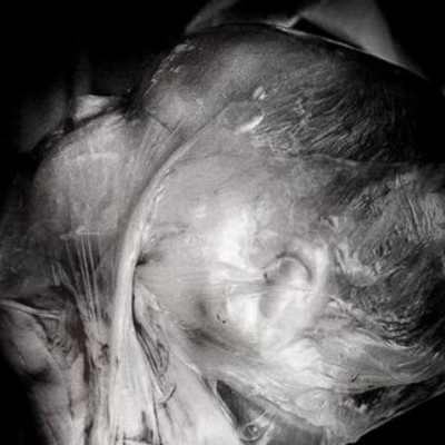 En Caul: Ένα σπάνιο φαινόμενο μέσα από φωτογραφίες