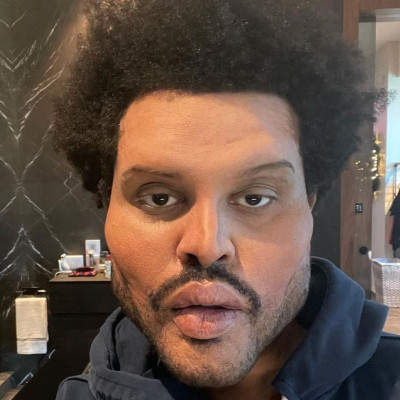 The Weeknd: Ξόδεψε επτά εκατομμύρια για την εμφάνιση αυτή