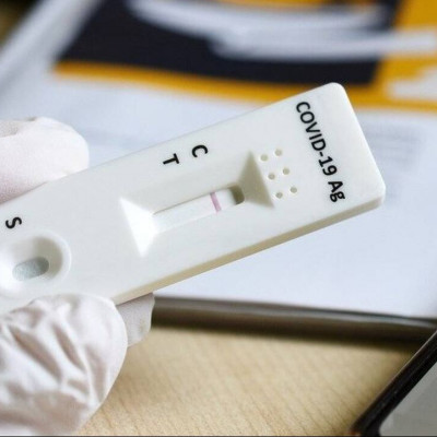 Δωρεάν rapid test: Βήμα βήμα η διαδικασία - Πόσο αξιόπιστα είναι;