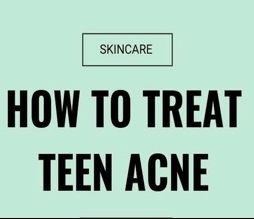 Πώς θα αντιμετωπίσεις την εφηβική ακμή; Η Σουζάνα Κεγγίτση έχει την απάντηση