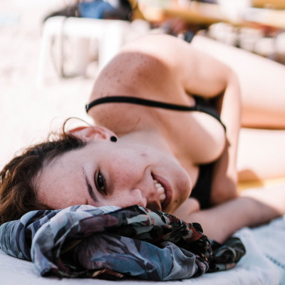 Κάηκες από τον ήλιο; Δες πώς μπορεί μια πατάτα να σε ανακουφίσει από το έγκαυμα