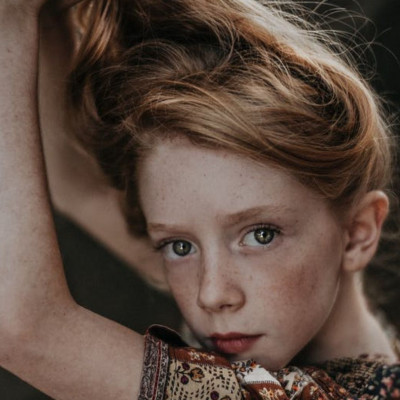 Τριχόπτωση στα παιδιά: Οι πιο συχνές αιτίες απώλειας των μαλλιών