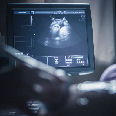 Αυχενική Διαφάνεια: Η πιο πολύτιμη εξέταση της εγκυμοσύνης