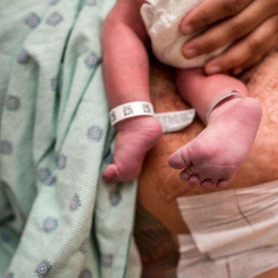 Οι μαμάδες της καισαρικής είναι όμορφες, δυνατές και γενναίες (εικόνες)