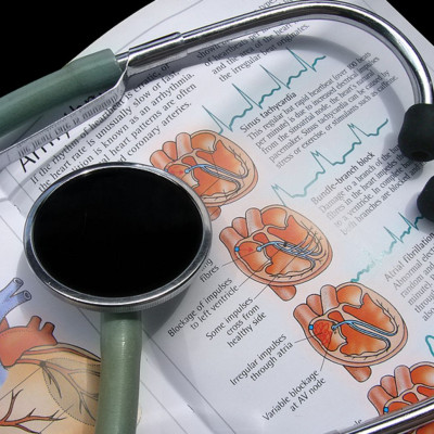 Κολπική μαρμαρυγή: Οι βασικές αιτίες της καρδιακής επιπλοκής (εικόνες)