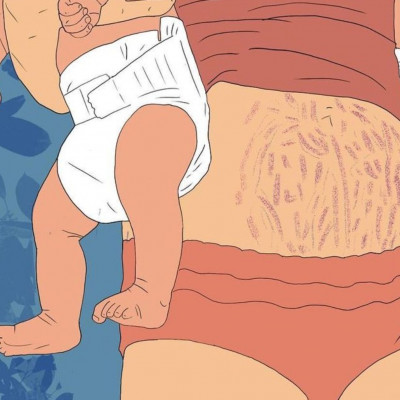 «Μαμά, οι ραγάδες και η χαλαρή κοιλιά είναι σημάδια της γενναιότητάς σου»