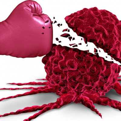 Παγκόσμια Ημέρα κατά του Καρκίνου: 10 συμπτώματα καρκίνου που πρέπει όλοι να γνωρίζουμε (εικόνες)