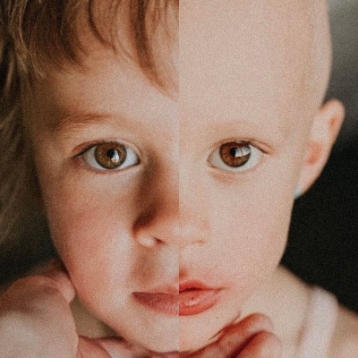 Μαμά κατέγραψε τη μάχη της κόρης της με τον παιδικό καρκίνο - Η ιστορία μίας μικρής νικήτριας