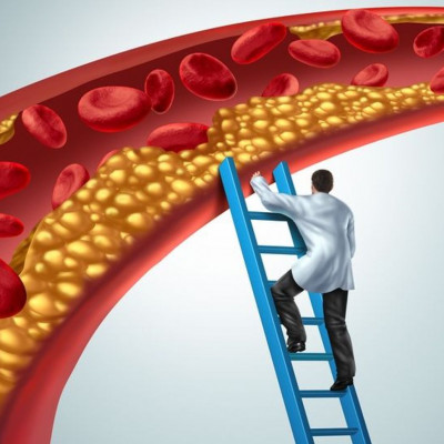 Στένωση αρτηριών: Τι να τρώτε και τι να αποφεύγετε (εικόνες)