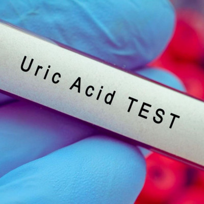 Υψηλό ουρικό οξύ: Τέσσερις διατροφικοί κανόνες για να το μειώσετε (εικόνες)