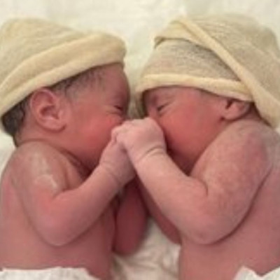 Μητέρα γέννησε δίδυμα –Το ένα μωρό ήταν μέσα στον αμνιακό σάκο (εικόνες)