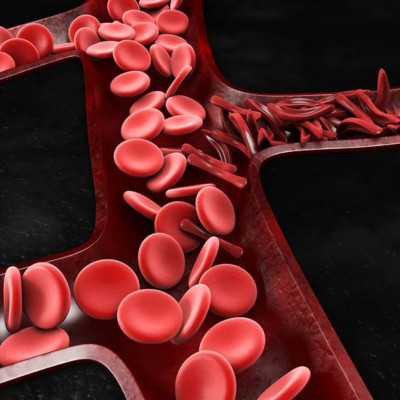 Προβληματική κυκλοφορία αίματος: Τα ορατά σημάδια που δεν πρέπει να αμελήσετε (εικόνες)