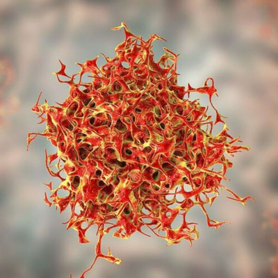 Νέα εξαιρετικά ελπιδοφόρα θεραπεία για τον καρκίνο σταματά την ανάπτυξη του ενός τρίτου των όγκων